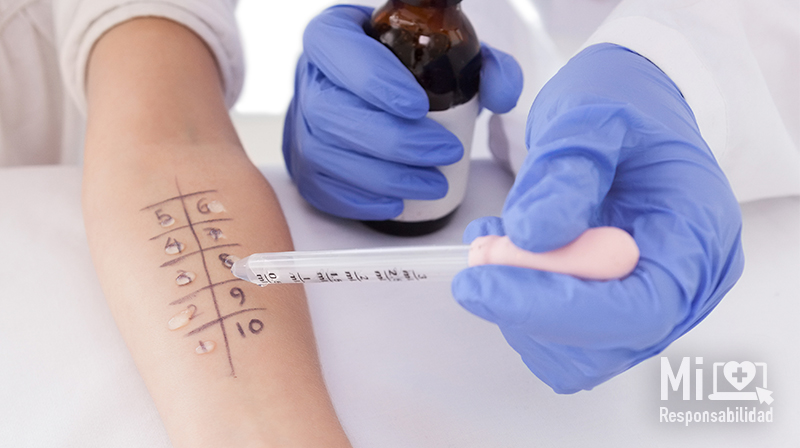 exámenes-para-alergias